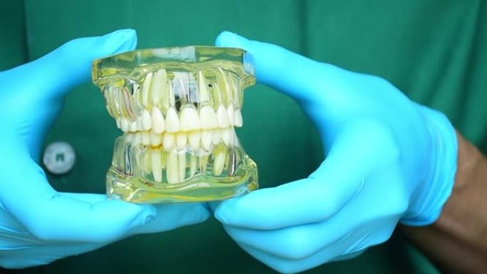 牙种植体模型。