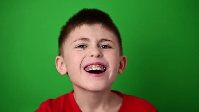 这个男孩微笑着，用牙板对准牙齿，进行牙科护理。