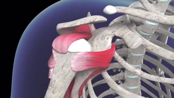 肩袖小新月撕裂的肩部损伤