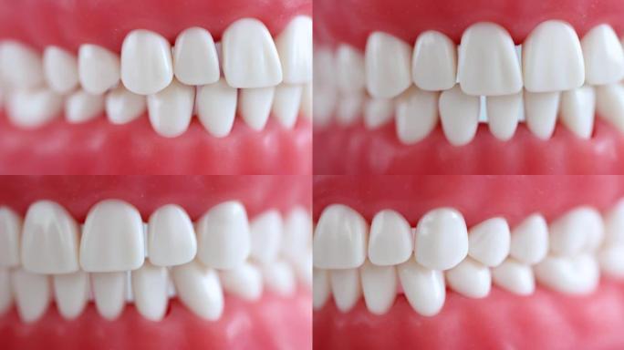 白色美丽的均匀牙齿，正确咬合人造下巴4k电影