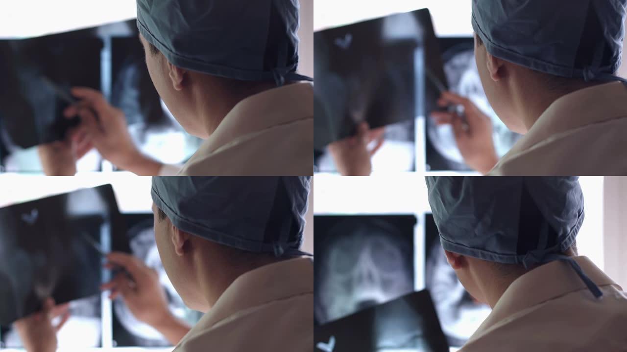 医院病房医生手中的x光照片。