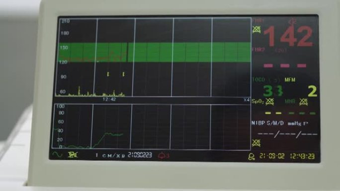 电子心脏照相机监测胎儿子宫的心脏收缩。打印心电图报告怀孕期间产房心电图。医疗诊断设备