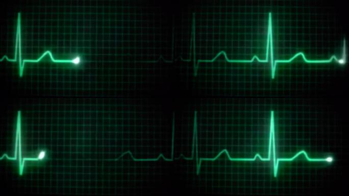 绿色的心率或心跳线。