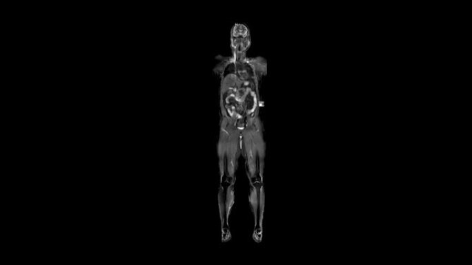 人体核磁共振成像。人体男性解剖三维动画生物学科学