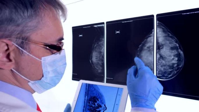医生分析乳腺癌的x射线