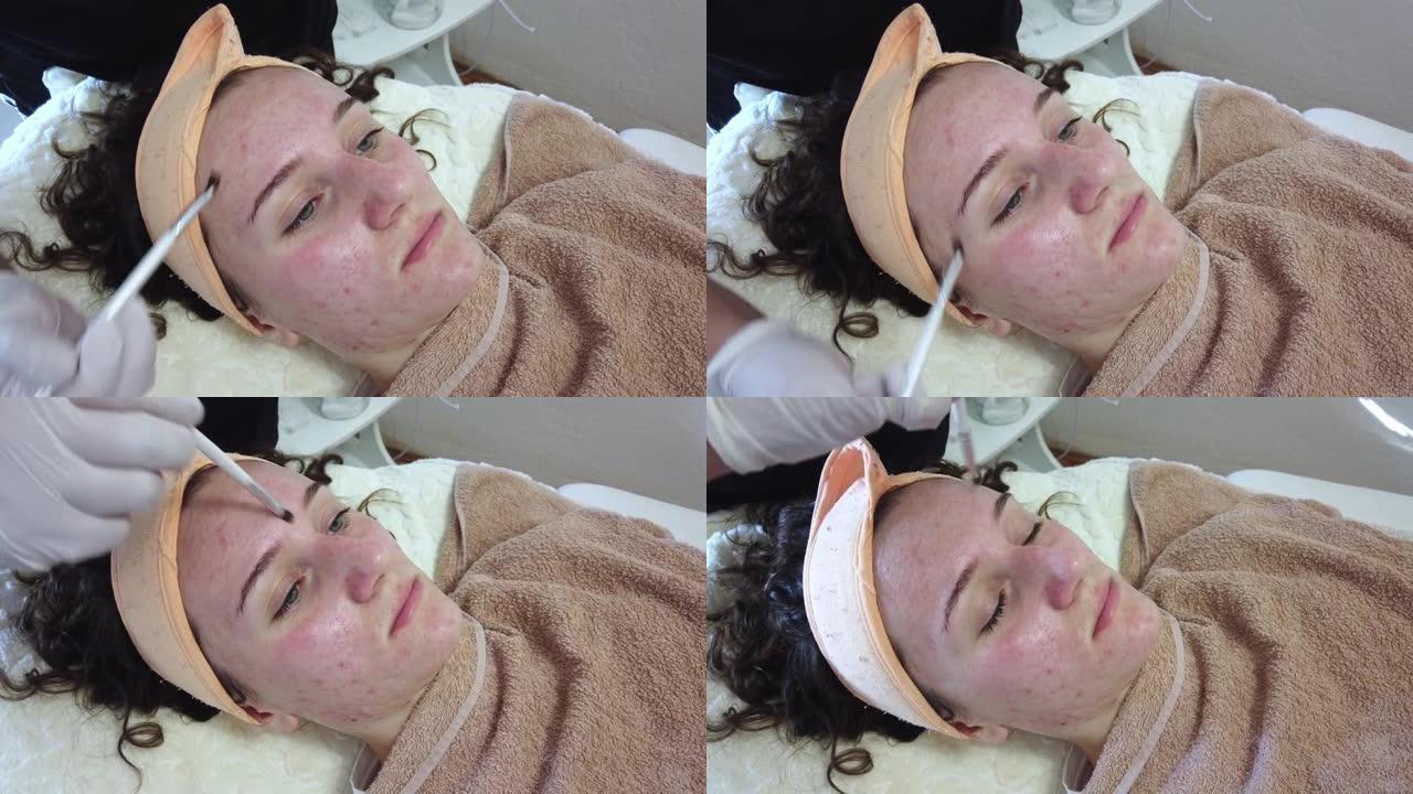 患有痤疮问题的年轻少女在皮肤科办公室或美容院接受面部治疗。毛孔清洁用清洁泡沫