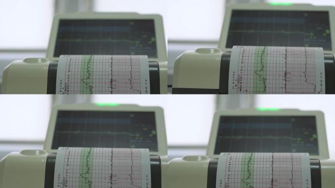 电子心脏照相机监测胎儿子宫的心脏收缩。打印心电图报告怀孕期间产房心电图。医疗诊断设备