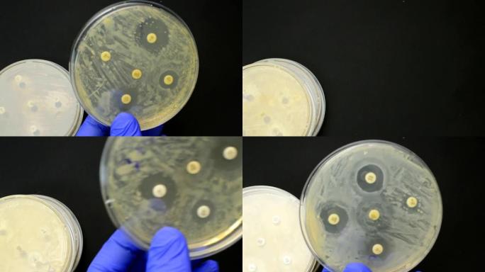 抗菌药片扩散试验的检查结果。抗生素图