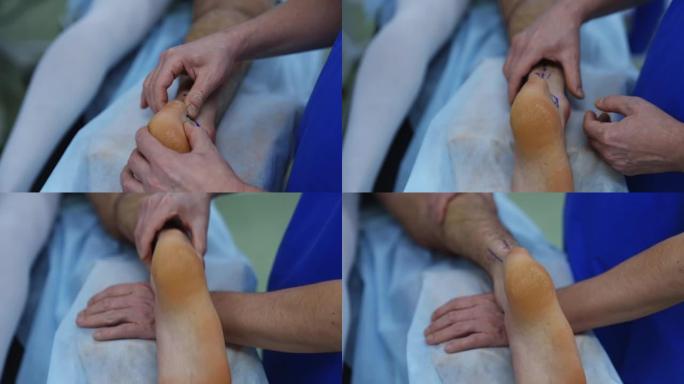 外科医生的手检查病人的腿。医生在手术前准备腿。诊所的医疗程序。特写。