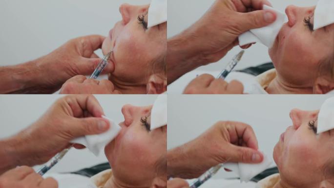 特写医生在美容医疗诊所用鼻唇沟中的透明质酸填充注射疼痛的整容手术