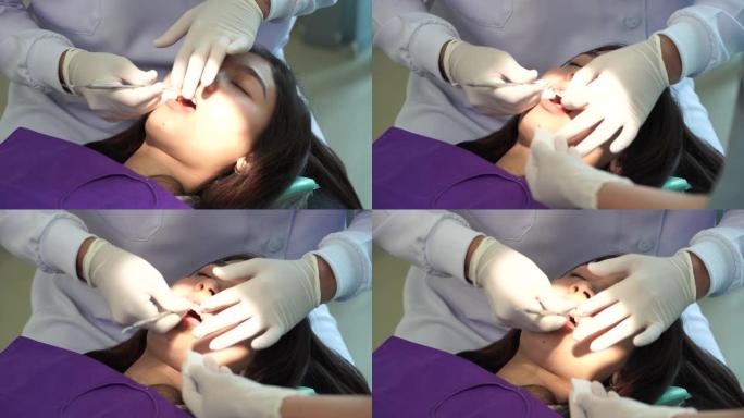牙科诊所为亚洲女性佩戴橡胶支架的牙医，正畸治疗。