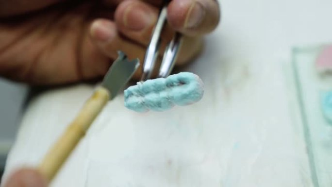 牙科技师在模型库存视频上应用牙齿升级