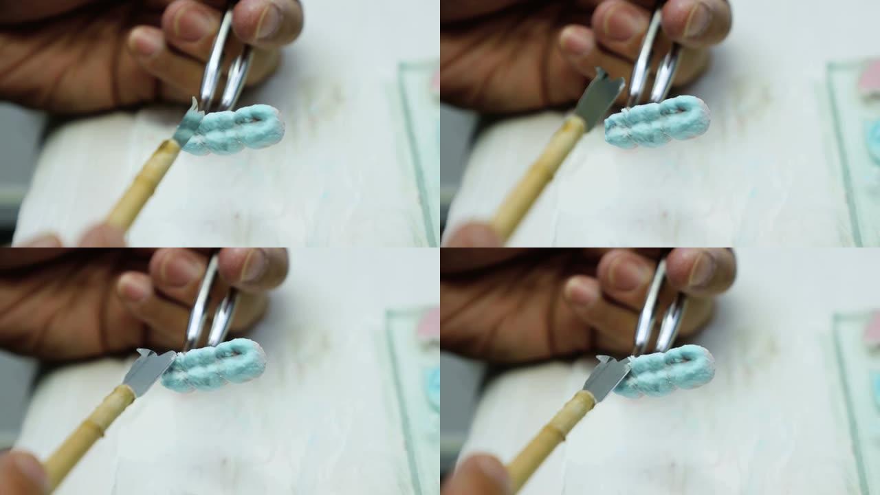 牙科技师在模型库存视频上应用牙齿升级