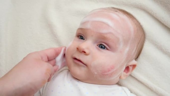 在患有皮炎和痤疮的婴儿脸颊上涂抹固化乳液或软膏。新生婴儿卫生、健康和皮肤护理的概念