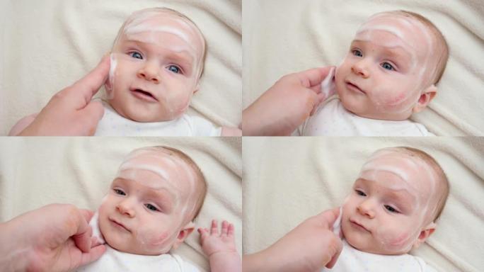 在患有皮炎和痤疮的婴儿脸颊上涂抹固化乳液或软膏。新生婴儿卫生、健康和皮肤护理的概念