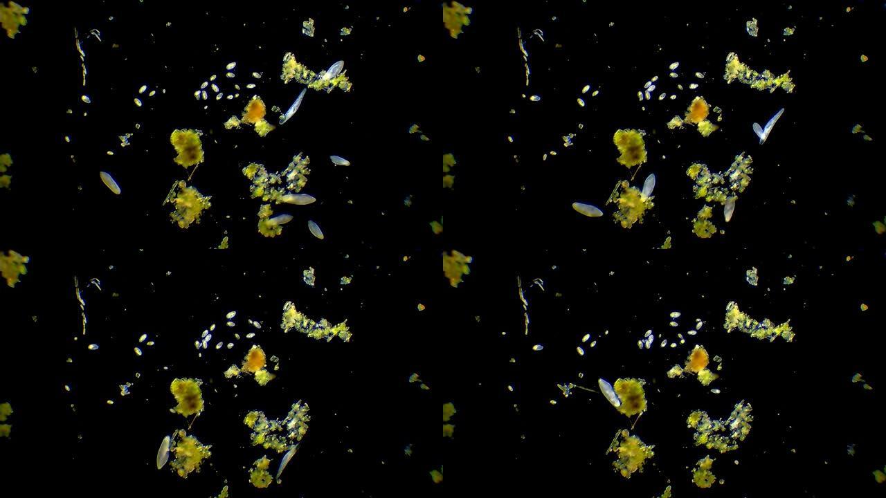 微生物-草履虫游离菌类残渣