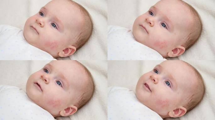 可爱的小婴儿的肖像，红色皮肤患有痤疮或皮炎。新生婴儿卫生、健康和皮肤护理的概念