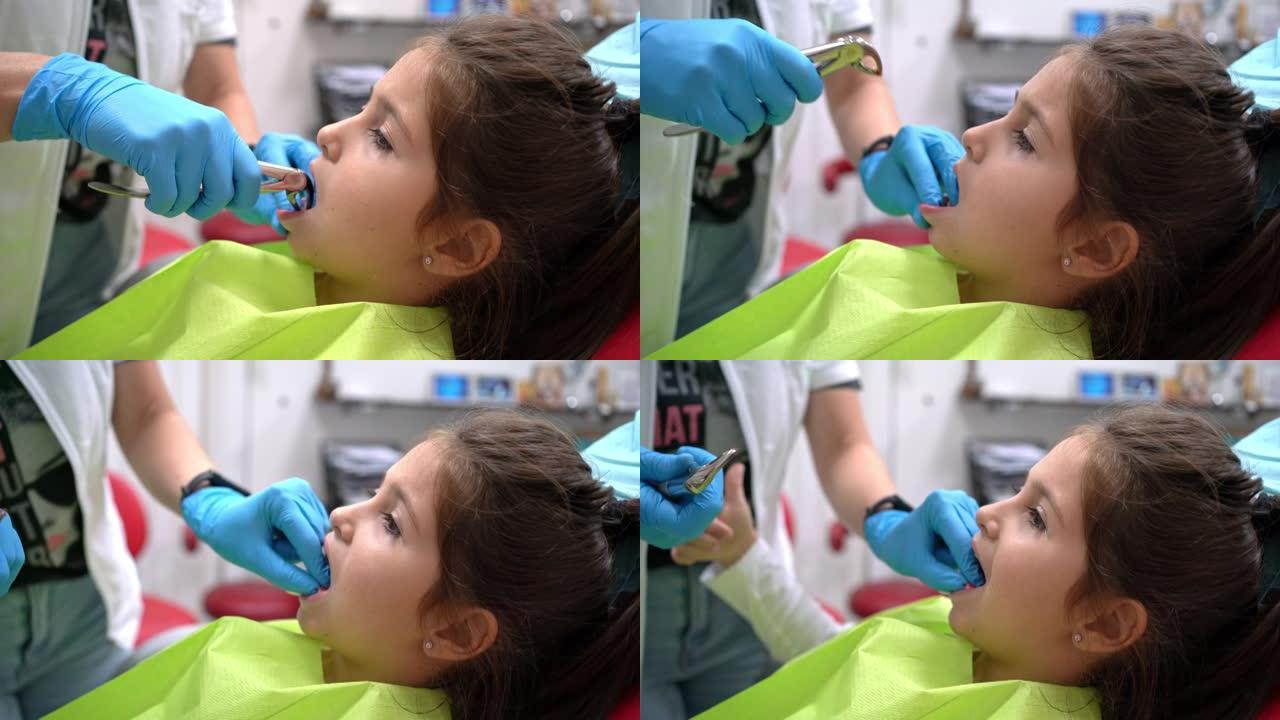 勇敢的女孩坐在牙医的椅子上，拔牙时露出拇指