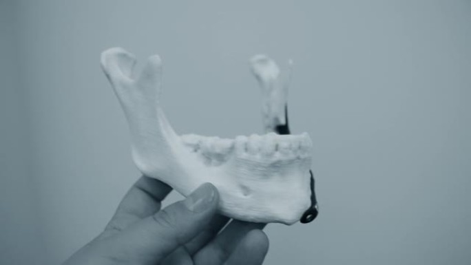 手持面部下颌骨假体的人在bionert钛合金特写的金属3D打印机上打印。颌面外科3D模型仿生植入物。