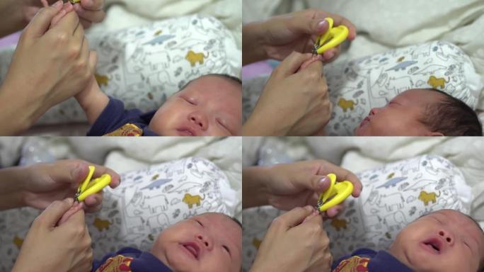 新生婴儿指甲被母亲割伤