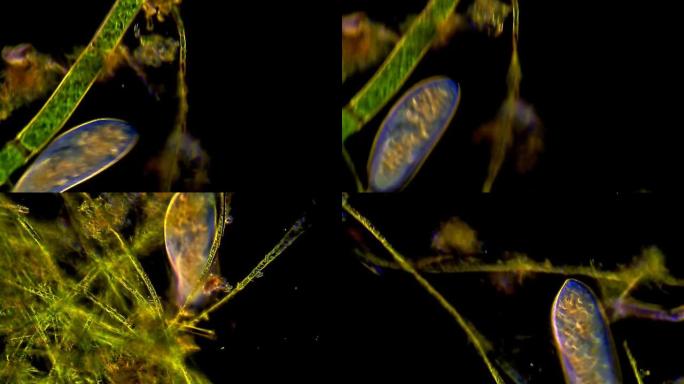 微生物-草履虫生物奥秘显微分析检查分析