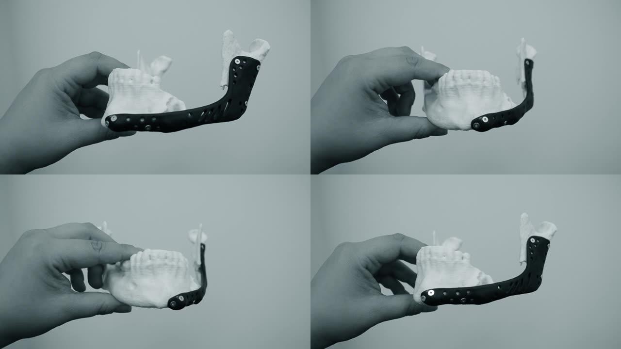 手持面部下颌骨假体的人在bionert钛合金特写的金属3D打印机上打印。颌面外科3D模型仿生植入物。