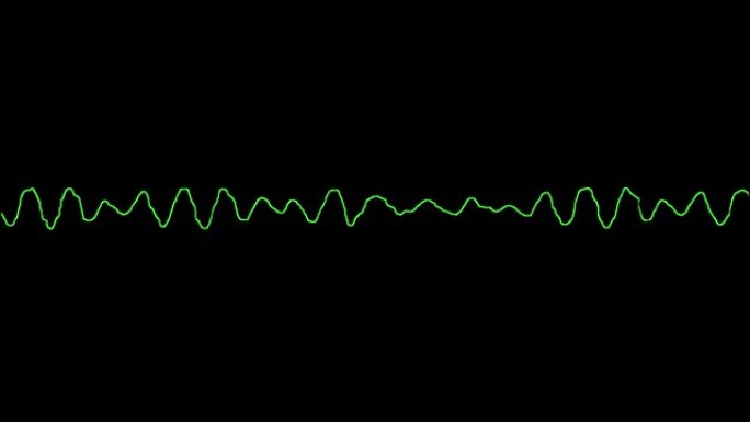 心电图显示心室纤颤