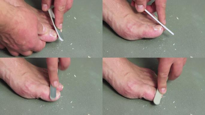 一个人的手用锉刀将大脚趾的指甲锉成。