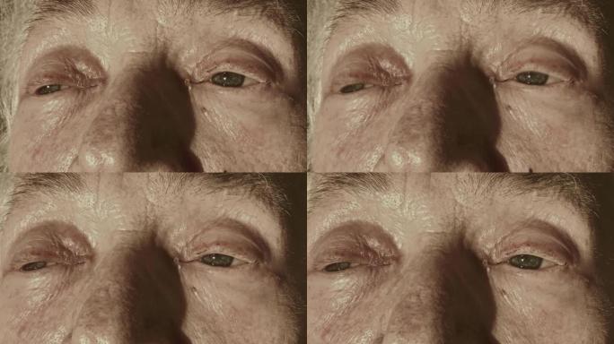 一个患有痴呆症的老女人的眼睛和日落。