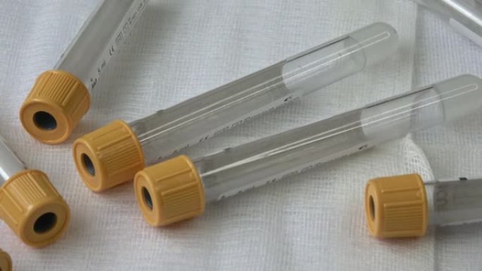 带有黄色盖的塑料试管，用于收集样品。医学现代医学