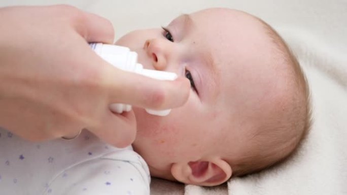 在患有皮炎的婴儿皮肤上涂抹保湿霜的特写镜头。新生儿健康和皮肤护理的概念