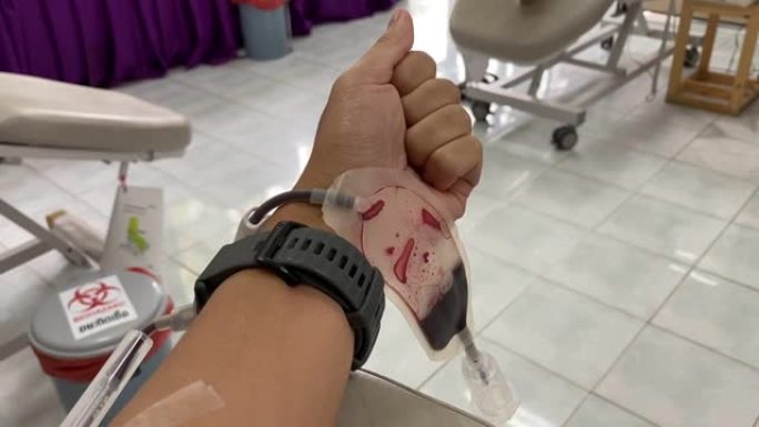 有人试图迅速张开和闭合他的手，喜欢在医院的输血中心献血时挤压球。