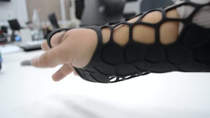 黑色矫形塑料假体印在手头的粉末3D打印机上。矫形石膏在手臂特写上。多喷射融合MJF 3D打印技术新的