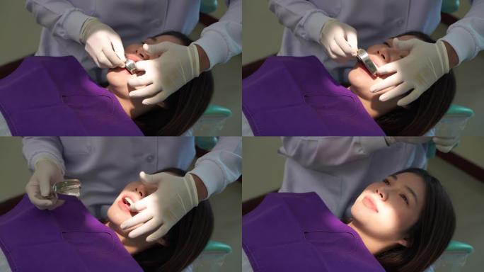 牙医在牙医诊所复制模型牙齿