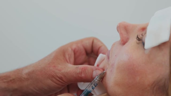 特写医生在美容医疗诊所用鼻唇沟中的透明质酸进行填充注射