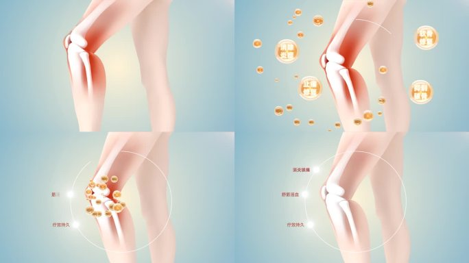 膝盖炎症修复