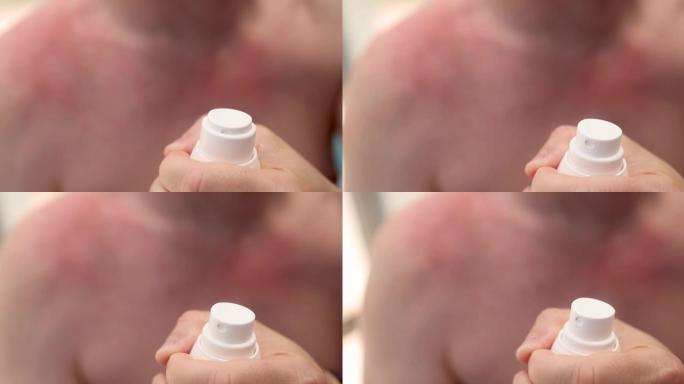 男子打开防晒喷雾保护皮肤免受sun 4k电影的侵害