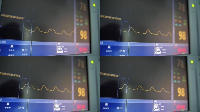 心脏心电图和屏幕上的数字。黄线在黑屏上以一定的心率移动。监护仪上心电图波浪线的运动。特写。