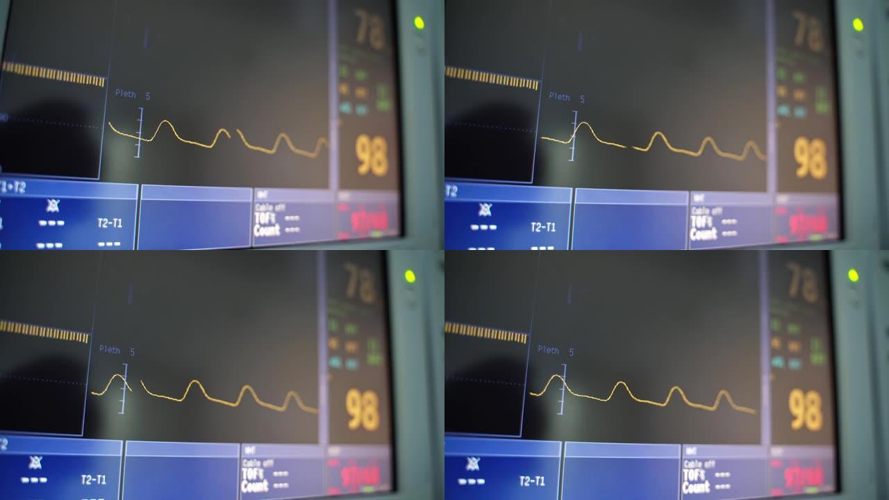 心脏心电图和屏幕上的数字。黄线在黑屏上以一定的心率移动。监护仪上心电图波浪线的运动。特写。