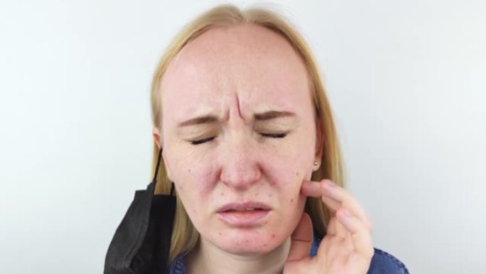 女人去除防护面膜，对面部皮肤产生刺激。抗病毒措施。抵御covid的手段19。长时间戴着面具。脸上长痘