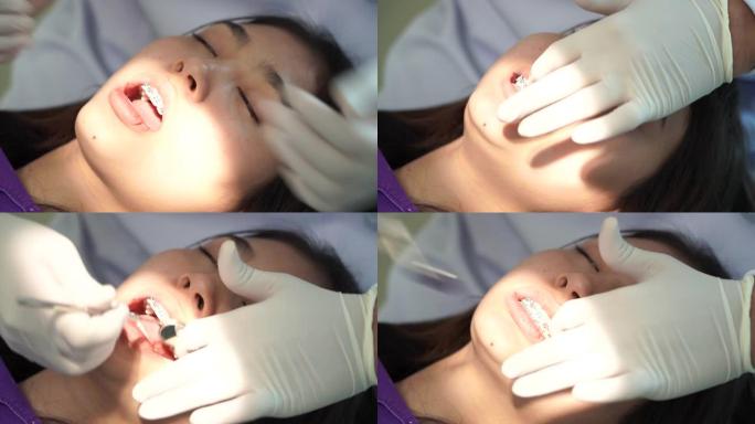 牙科诊所为亚洲女性佩戴橡胶支架的牙医，正畸治疗。