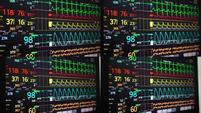 生命体征监测屏幕医疗治疗医治诊治心电图