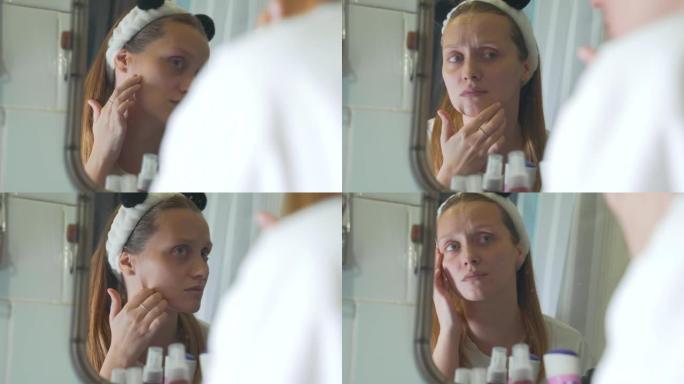 年轻的白人妇女在浴室的镜子里看着自己，检查她的脸部皮肤，感到不安。脸上有红肿和丘疹。这个女孩很沮丧。