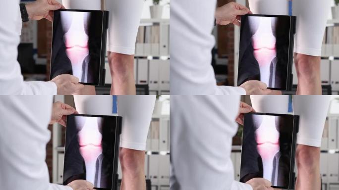医生拿着数字平板电脑，病人腿附近有膝盖x光特写4k电影慢动作