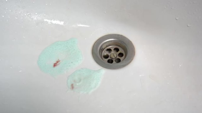 水槽里有血的牙膏。刷牙时有血