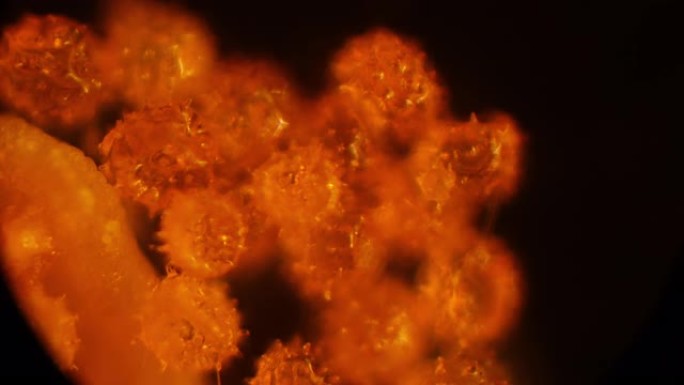 显微镜下的花粉。人类最常见的过敏原之一。