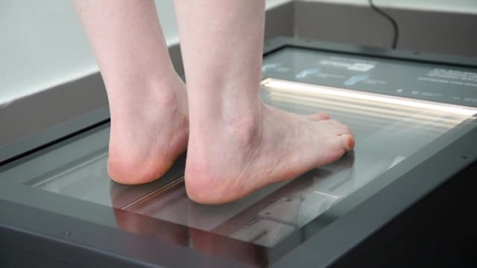 停止扫描过程。扁平脚的类型和程度的测定。骨科医生对脚进行诊断。用于确定足弓状态的现代设备