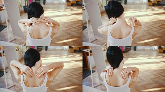 无法识别的白癜风色素沉着的女人在家按摩背部和肩膀肌肉，慢动作
