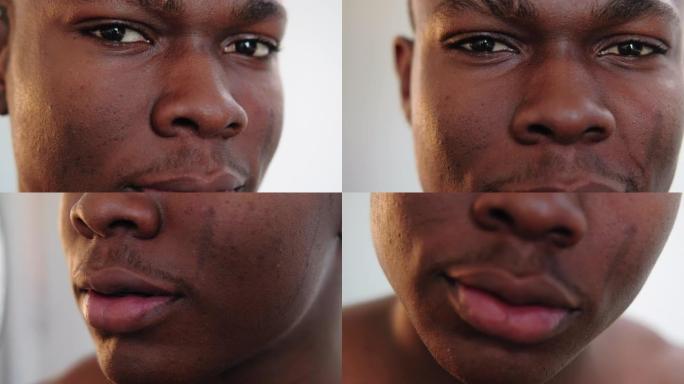 皮肤问题面部治疗非洲男子痤疮