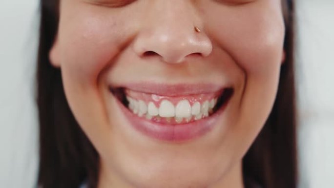 完美的女人牙齿特写。一个真诚微笑，牙齿洁白的女人
